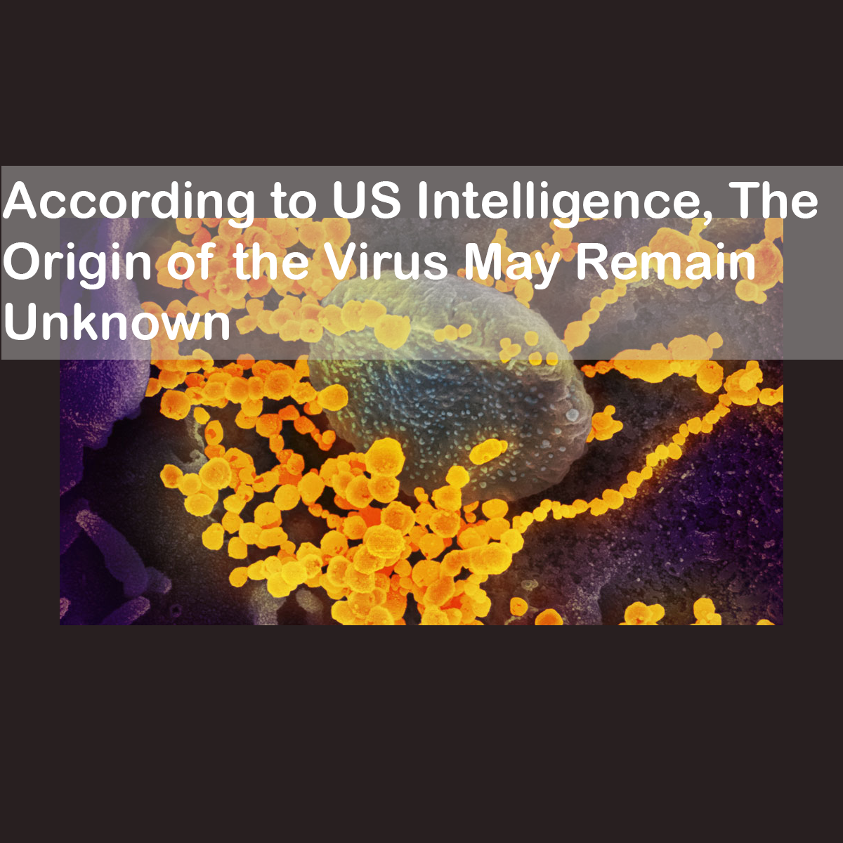 According to US Intelligence, The Origin of the Virus May Remain Unknown
